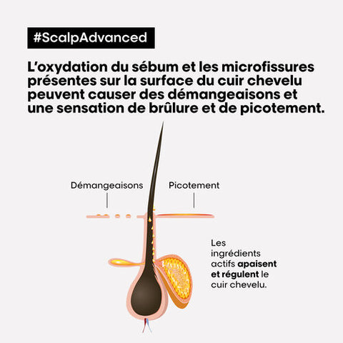 Scalp Advanced Anti-Inconfort Traitement Profesionnel