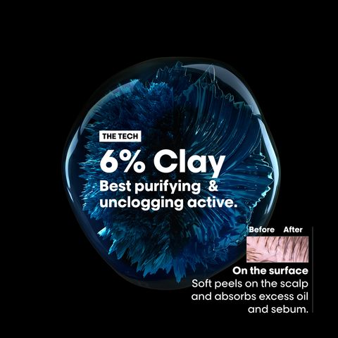 Scalp Advanced Anti-Gras Shampooing Professionnel