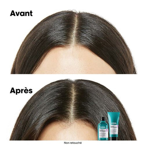 Scalp Advanced Anti-Inconfort Shampooing Professionnel Recharge