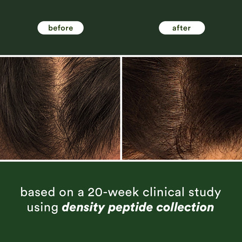 Verb - Peptide Density Serum